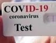  SARS-CoV-2. Indagine sieroprevalenza